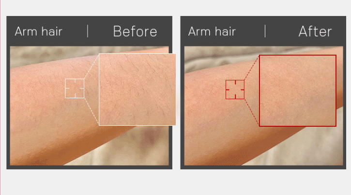 [BEAUND] Hair Trimmer. Facial hair, arm hair, leg hair, 2 shaver heads