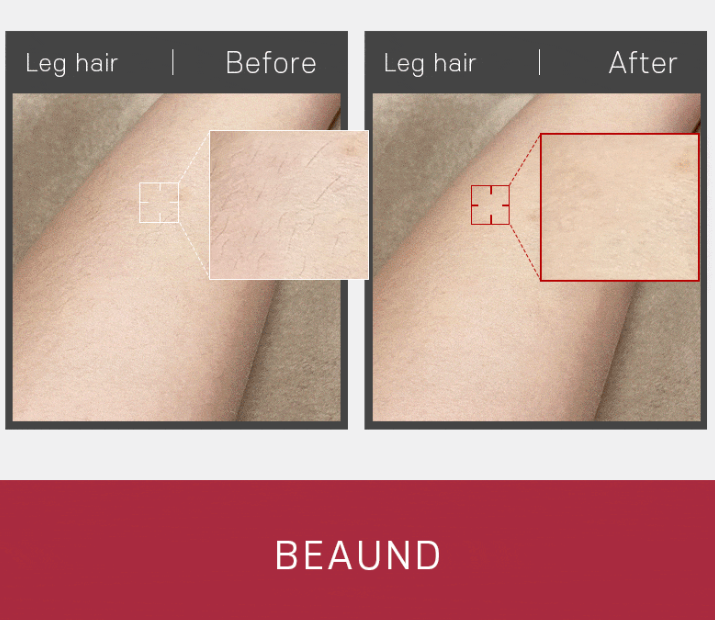 [BEAUND] Hair Trimmer. Facial hair, arm hair, leg hair, 2 shaver heads